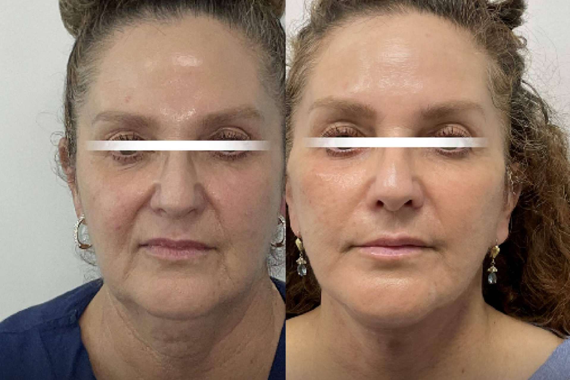 Top Celebrity Plastic Surgeon Brings Beverly Hills Beauty to Miami
